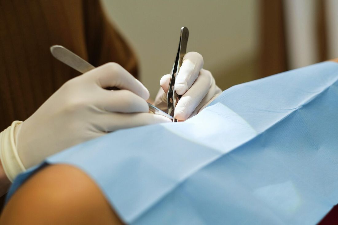 Procedimento dermatológico em andamento